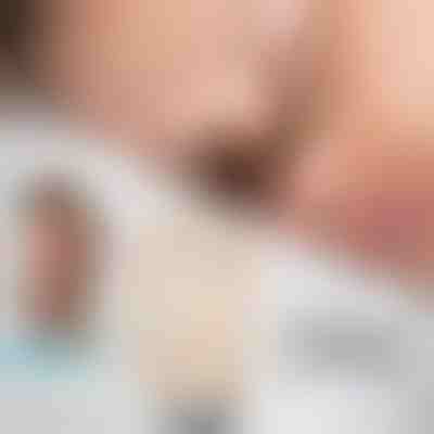 Μαγνητικός διαστολέας ρινός | EASYBREATHE